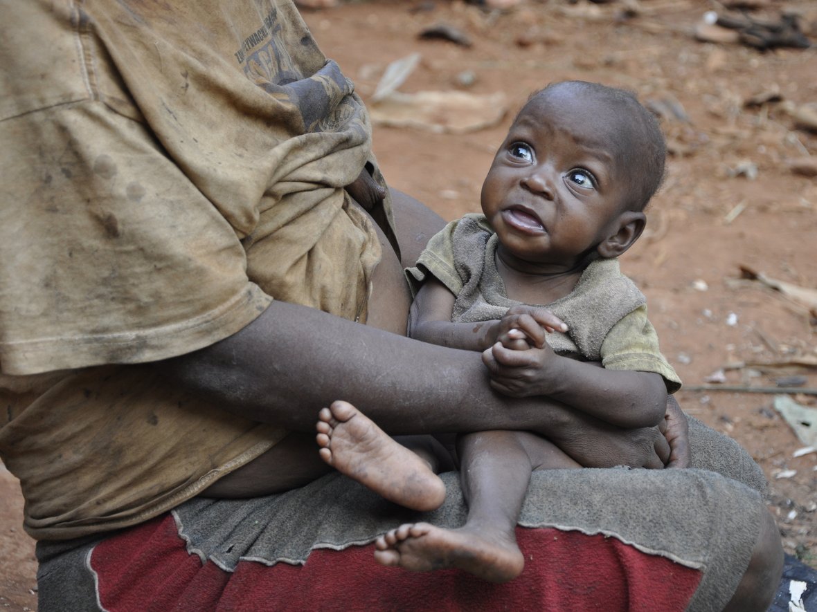 Life Package for starving children. Help us fill an empty plate... - main photo