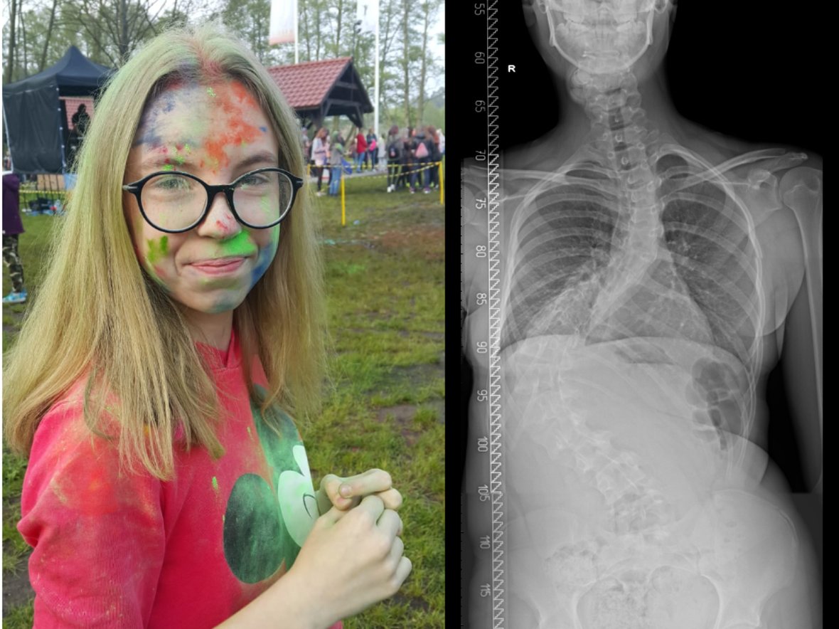 Malwina Piotrkiewicz - main photo