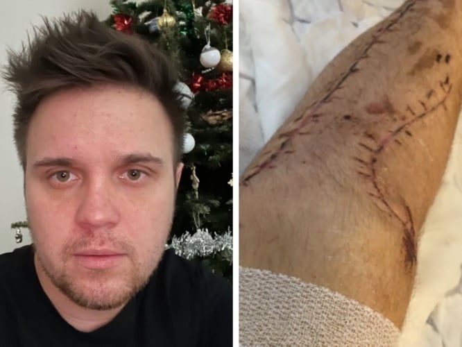 Patryk Lesiuk - main photo