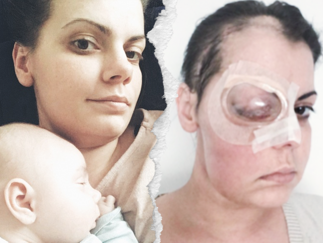 Agnieszka Krugiołka - zdjęcie główne