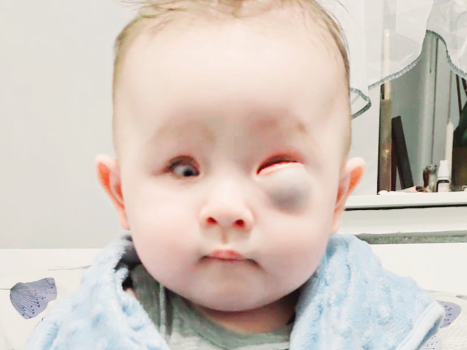 Luka Dmytriv - zdjęcie główne