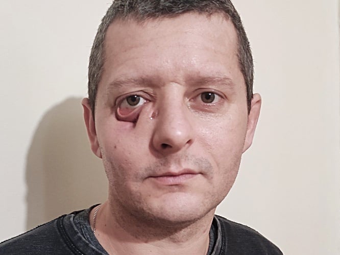 Piotr Ignatiuk - zdjęcie główne