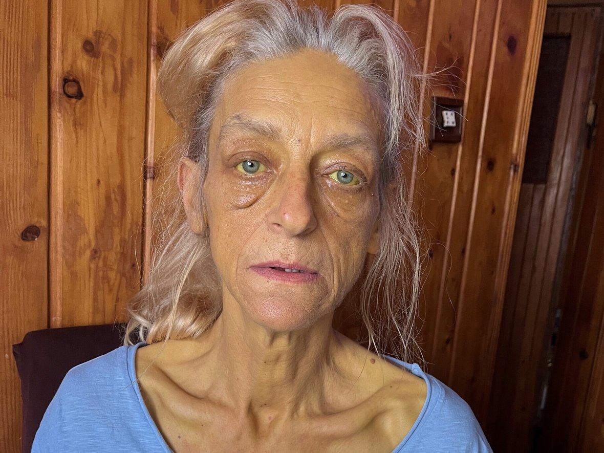 Elżbieta Pytlak - zdjęcie główne