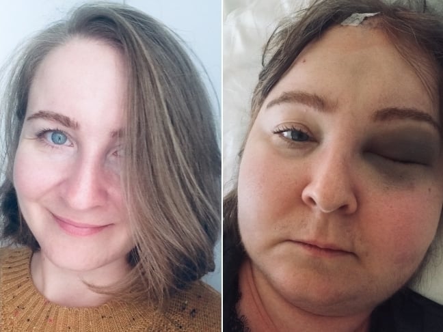 Monika Kaleta - zdjęcie główne