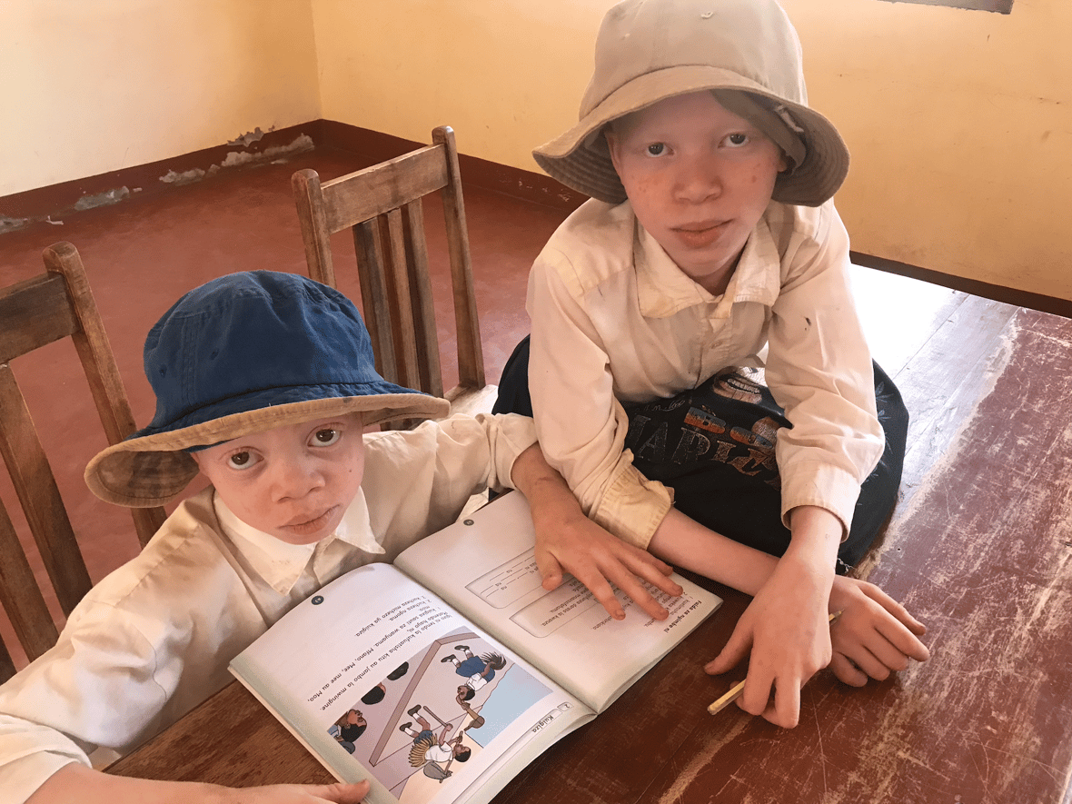 Pomóżmy zagrożonym dzieciom z albinizmem w Tanzanii❗️ - main photo