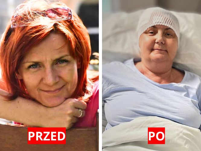 Aneta Bzinkiewicz - zdjęcie główne