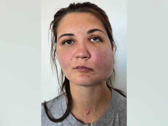 Anastasiia Khaustova - main photo