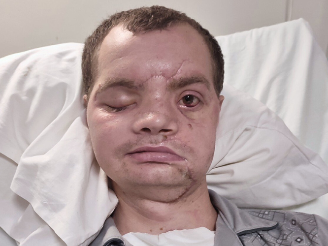 Zbyszek Sadoch - zdjęcie główne