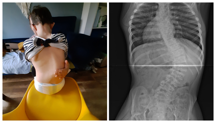 Maksymilian Szendera