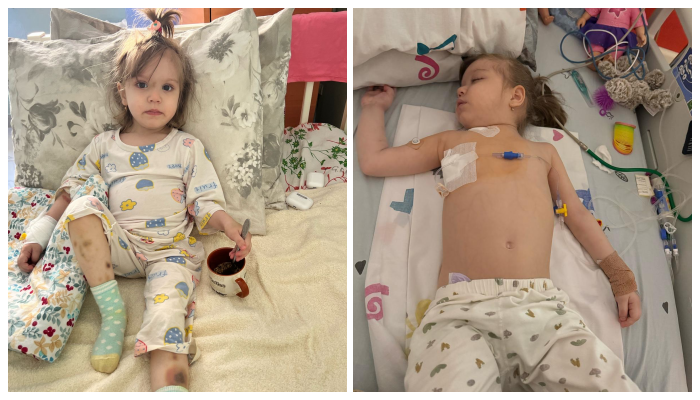 Selina: A Courageous Young Girl Battling for Her Life After a Bone Marrow Transplant Selina Allakuliyeva