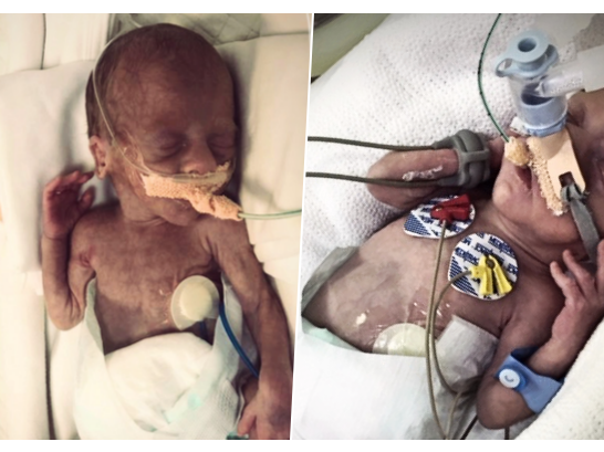 Helenka Willmes - zdjęcie główne