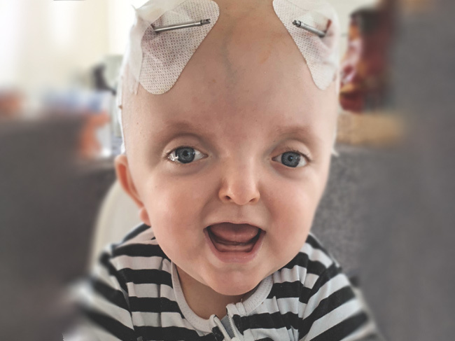 Leoś Szczepaniak - zdjęcie główne