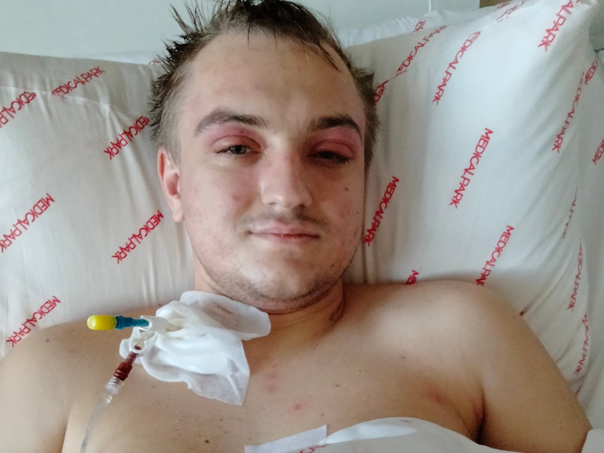 Anton Oriekov - zdjęcie główne