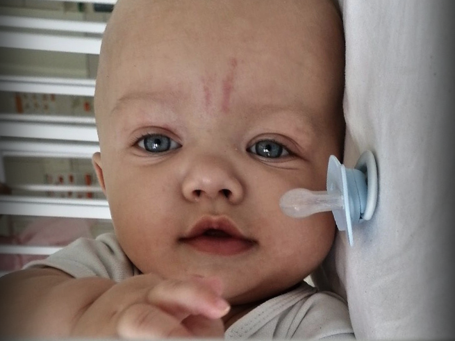 Antoś Bydołek - main photo