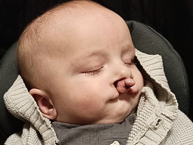 Natan Lewkowski - zdjęcie główne