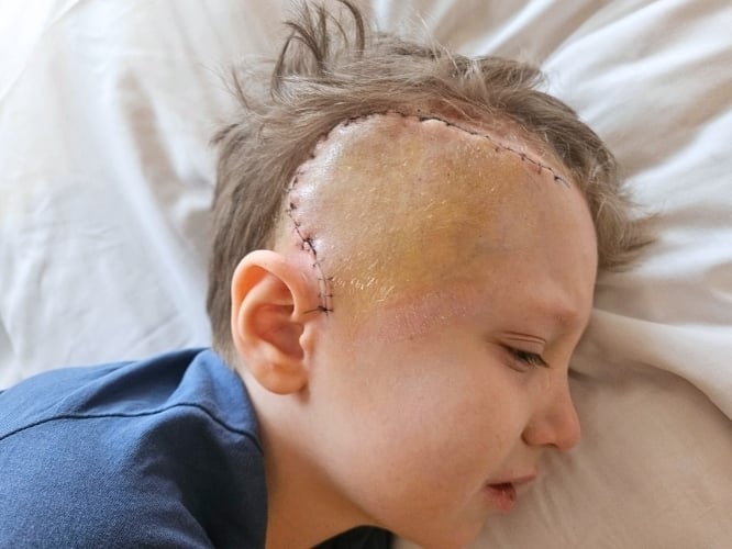 Bartuś Bronowski - zdjęcie główne