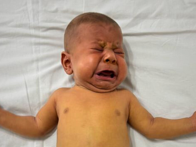 Ashraf Muzafforow - zdjęcie główne