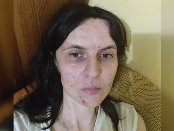 Anna Żur - zdjęcie główne