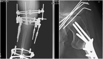 Wiktoria Trojanowicz