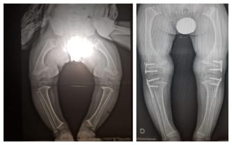 Jurek Carrera-Gnaciński