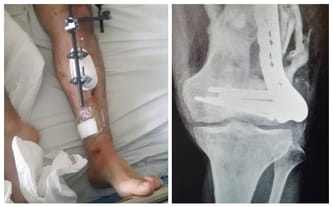 Mateusz Kożuchowski