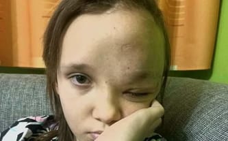 Skarbonki Fundacji DOBROWRACA MG