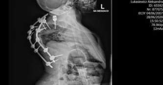 Aleksandra Łukasiewicz