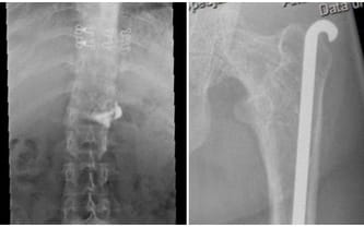 Natalia Andruszkiewicz