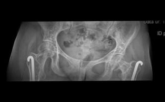 Natalia Andruszkiewicz