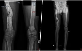 FUNDACJA CZŁOWIEK TAKI JAK TY