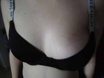 Rekonstrukcja piersi - zwalczanie problemów psychicznych i emocjonalnych