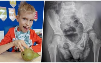 Oskar Kołodziejczyk