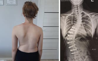 Malwina Piotrkiewicz