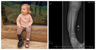 Wrocław Biegamy i pomagamy Antosi