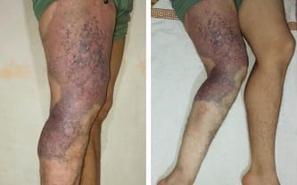 Zine Eddine Boukadoum