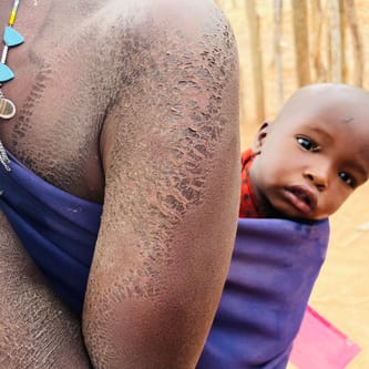 Świąteczna zbiórka na lekarzy dla dzieci w wiosce masajskiej Oltotoi Africa Help