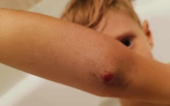 Nikodem Szałankiewicz