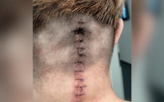 Aneta Laskowska-Bielawska