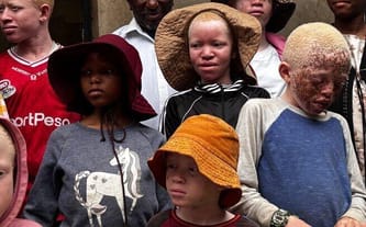 Dzieci z sierocińca chcą tylko w styczniu wrócić do szkoły! Pomóż im, bo albinizm w Tanzanii to zagrożenie dla życia. Fundacja ADRA Polska