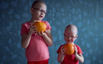 Wielkanocny Zajączek dla dzieci z onkologii – podaruj uśmiech i odrobinę radości