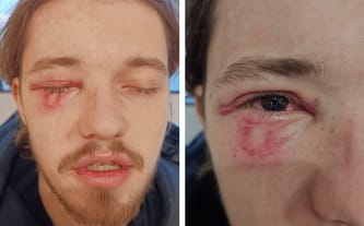 Krzysztof Łopatniuk