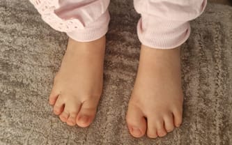 Na ratunek dzieciom z SLOS!