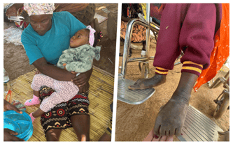 Wózki inwalidzkie dla chorych w buszu – pomóż Siostrze Józefie