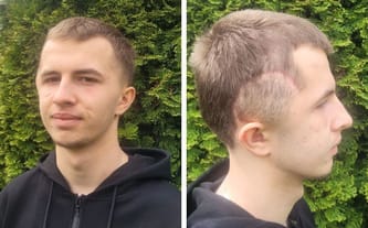 Kacper Mika