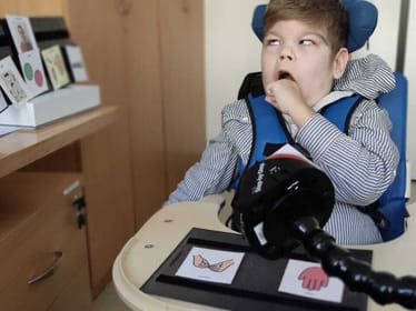 Elektrostymulacja w terapii zaburzeń połykania u dzieci z mózgowym porażeniem - zdjęcie główne