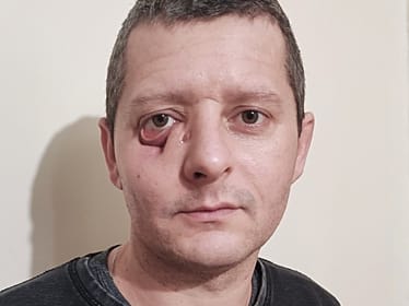 Piotr Ignatiuk - zdjęcie główne