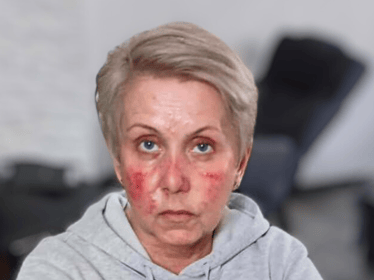 Agnieszka Brania - main photo