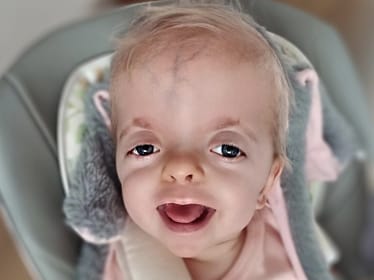 Pola Brol - zdjęcie główne