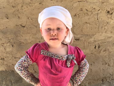 Dajmy Halimie i innym opuszczonym dzieciom z albinizmem nadzieję na lepsze jutro! - zdjęcie główne