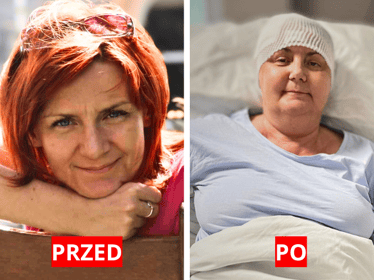 Aneta Bzinkiewicz - main photo